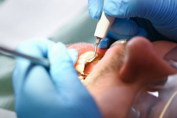 Best Weekend Emergency Dentist in Arapahoe, WY
