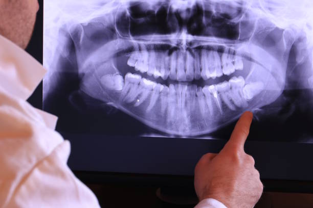 Best Emergency Tooth Extraction in Arapahoe, WY